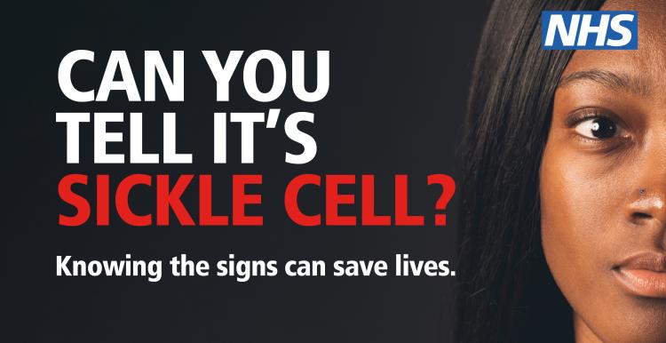 Can you tell it's sickle cell? banner with woman looking at camera