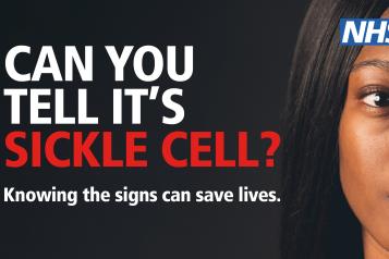 Can you tell it's sickle cell? banner with woman looking at camera